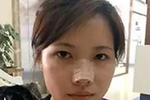 整容医生爆料视频下载,医生亲述幕后真相与风险 第2张 整容医生爆料视频下载,医生亲述幕后真相与风险 第2张